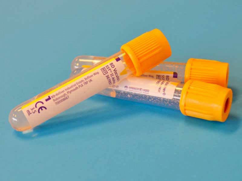 analisis clinico